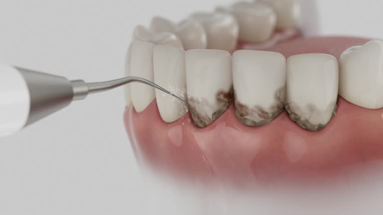 Trusted Dental Implants service in Baltimore, OH - Dentist Open Now